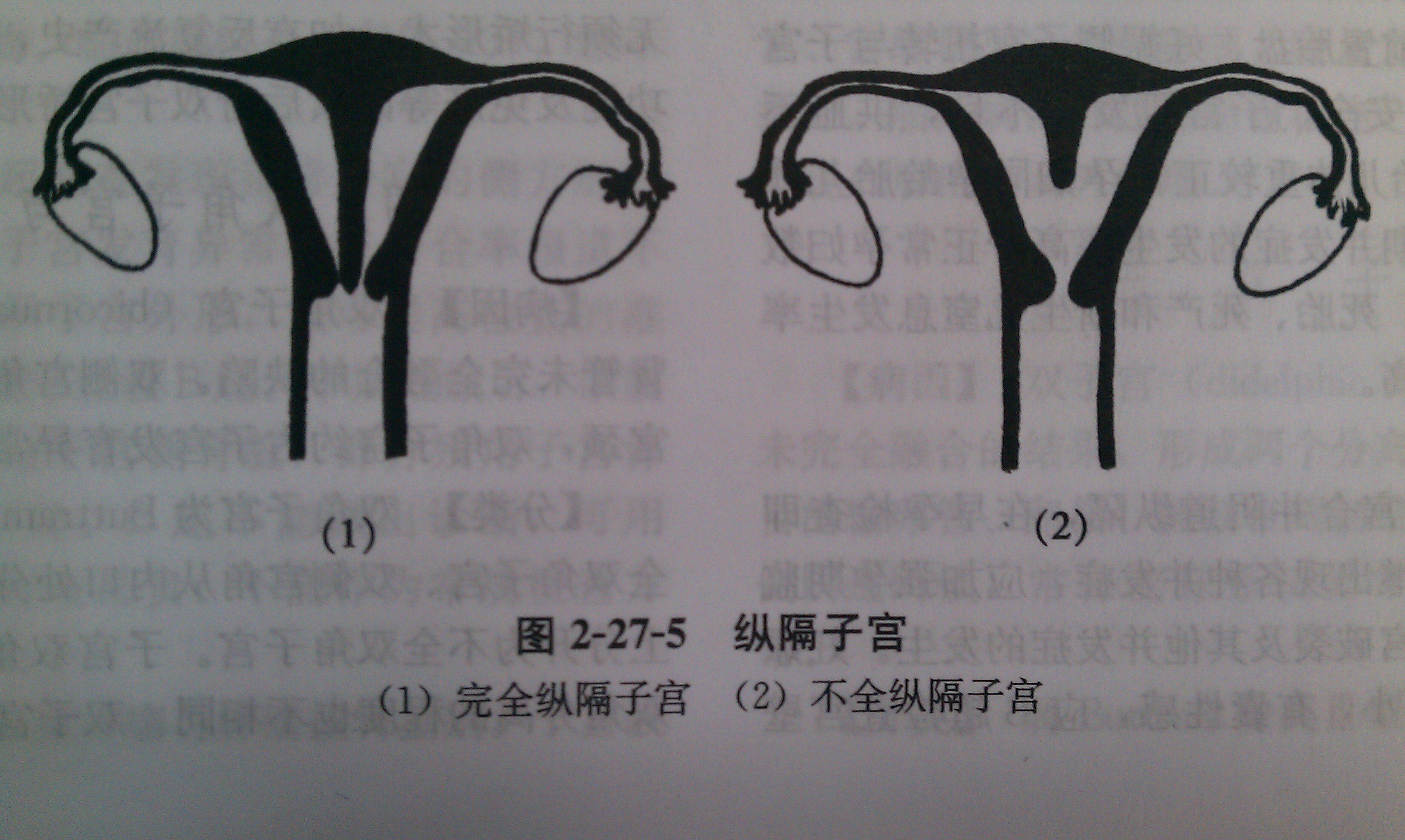 全面解析：MX6刷机教程，一步步带你成为刷机达人 (全面解析美元如何霸权)